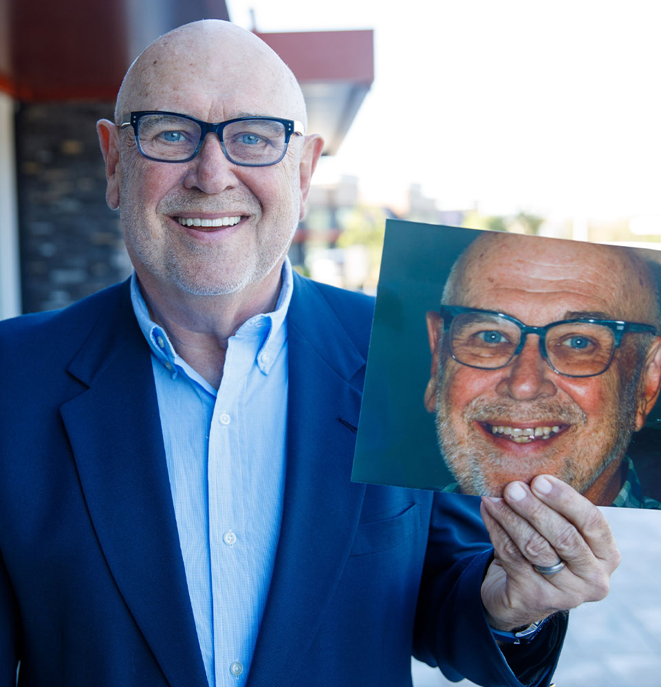 patient smiling after their procedure while holding up their before procedure picture